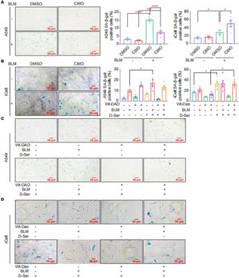 Triiodothyronine acts on DAO to regulate pulmonary fibrosis progression by facilitating cell senescence through the p53/p21 signaling pathway